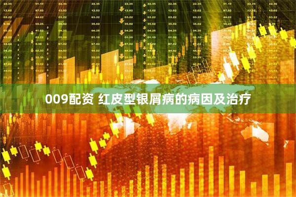 009配资 红皮型银屑病的病因及治疗